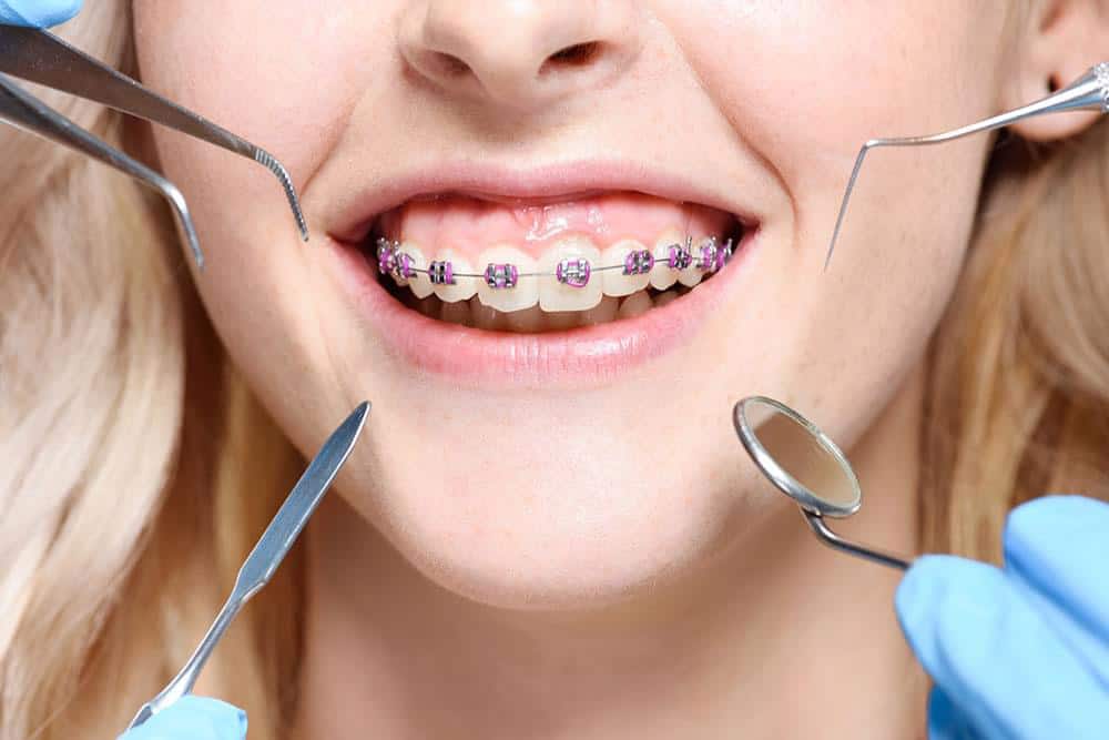 What Is Orthodontics Branch of Dentistry?