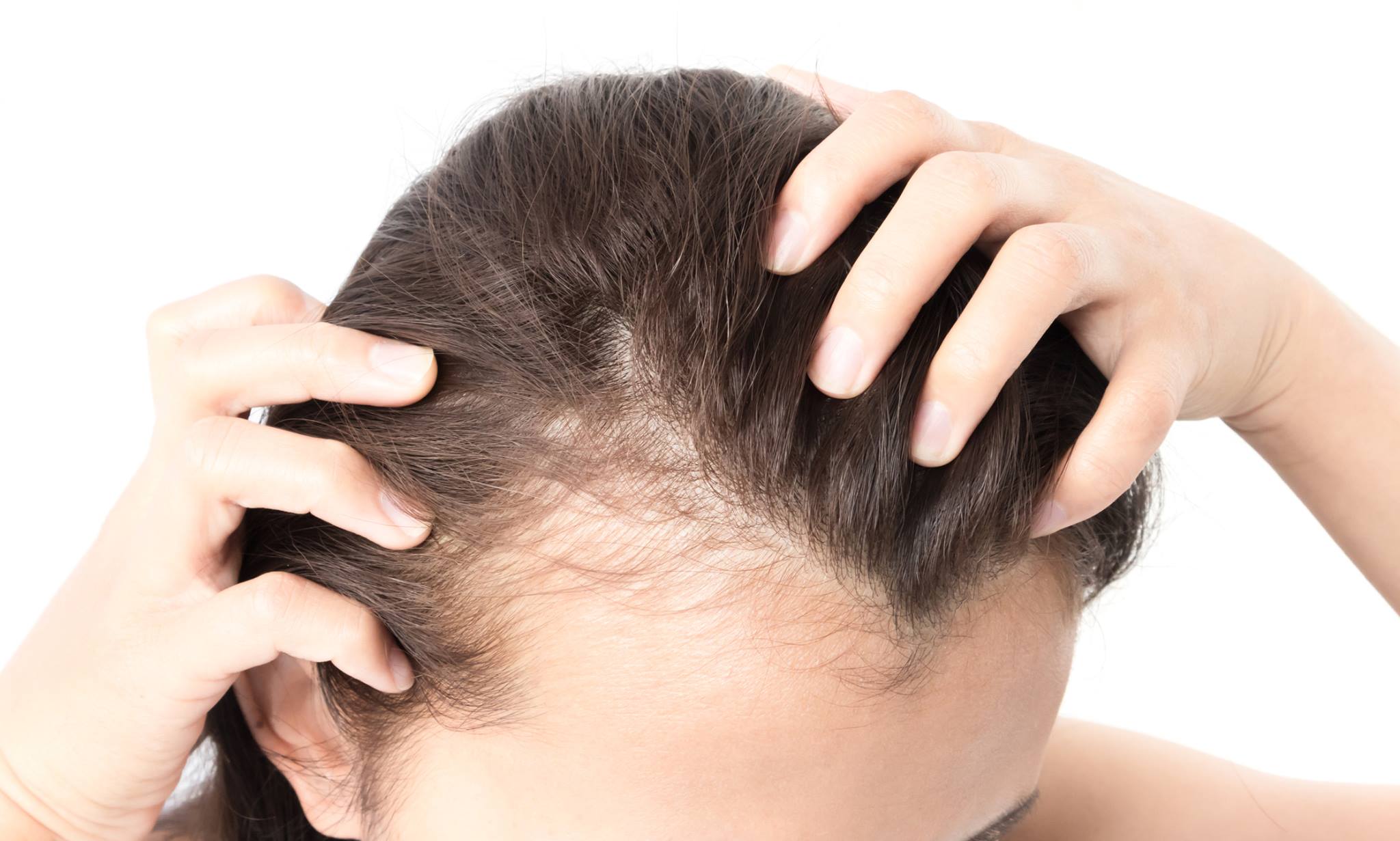 non-surgical hair loss treatment New Jersey