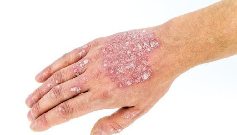 dermatologist Long Beach CA