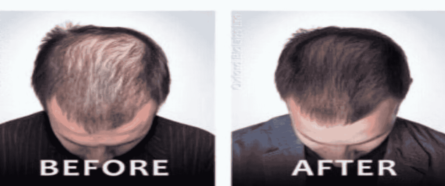 hair loss treatment center New Jersey